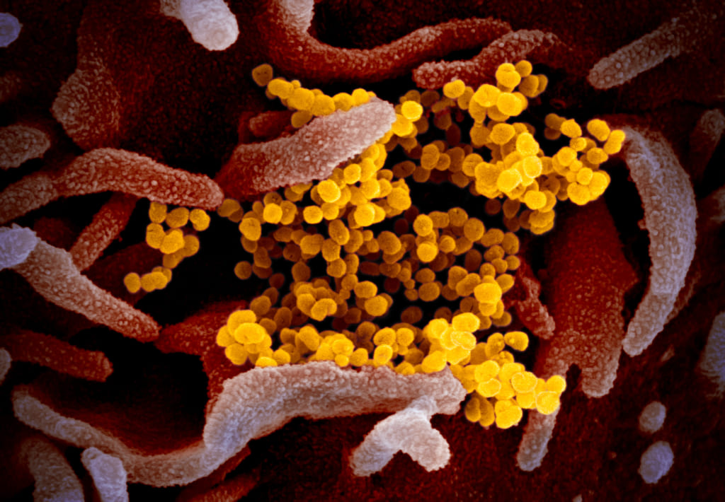 Hình ảnh virus SARS-CoV-2 đang gây ra dịch Covid-19 - một mầm bệnh yêu cầu BSL-3 và BSL-4